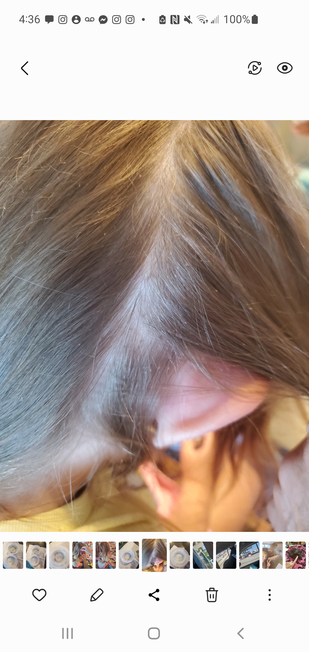 Lice Busters 805